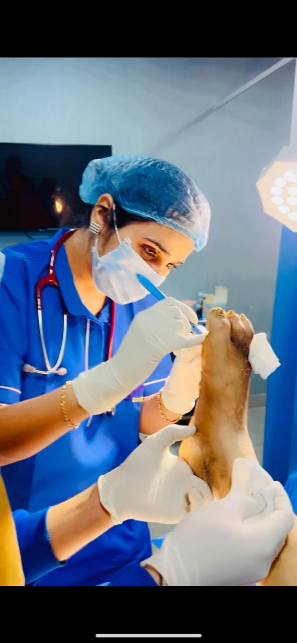 Dr. Beant Sidhu performing diabetic foot treatment at Gini Hospital